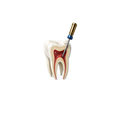 Endodontics